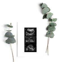 Load image into Gallery viewer, Ultrasound Baby Scan Milestones Print