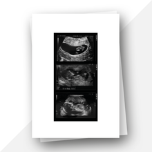 Load image into Gallery viewer, Ultrasound Baby Scan Milestones Print
