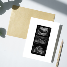 Load image into Gallery viewer, Ultrasound Baby Scan Milestones Print
